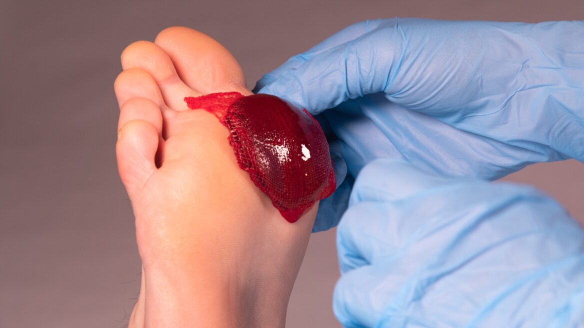 blood cell fragments used to clot blood are called blood cell fragments used to clot blood are called